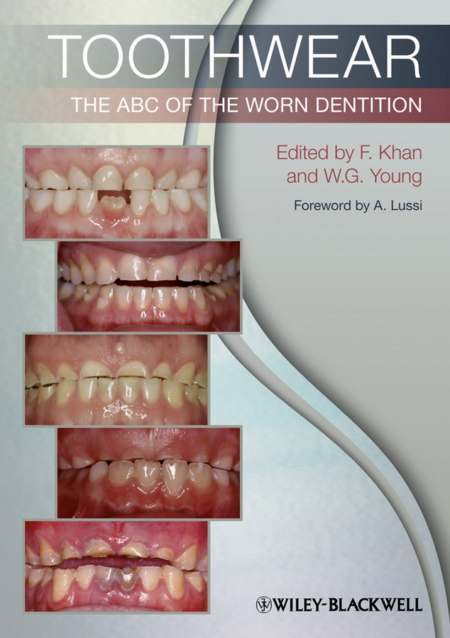 Toothwear. The ABC of the Worn Dentition