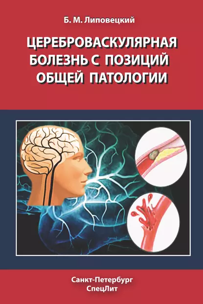 Обложка книги Цереброваскулярная болезнь с позиций общей патологии, Б. М. Липовецкий