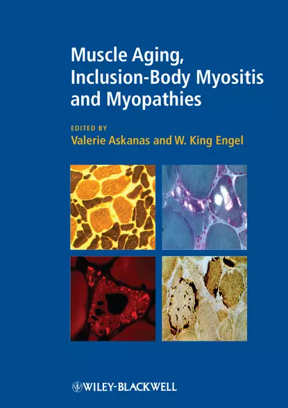 Обложка книги Muscle Aging, Inclusion-Body Myositis and Myopathies, Engel W. King