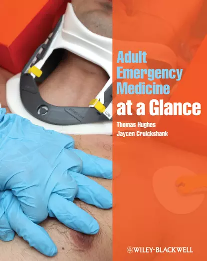 Обложка книги Adult Emergency Medicine at a Glance, Hughes Thomas