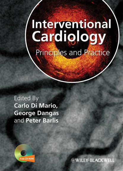 

Interventional Cardiology. Principles and Practice