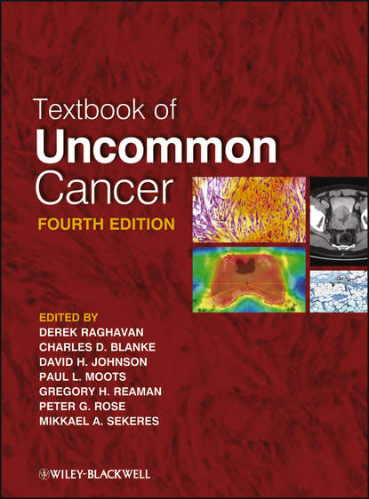 

Textbook of Uncommon Cancer