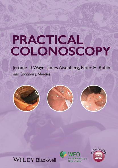 Practical Colonoscopy - Jerome D. Waye