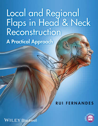 Local and Regional Flaps in Head and Neck Reconstruction - Rui  Fernandes