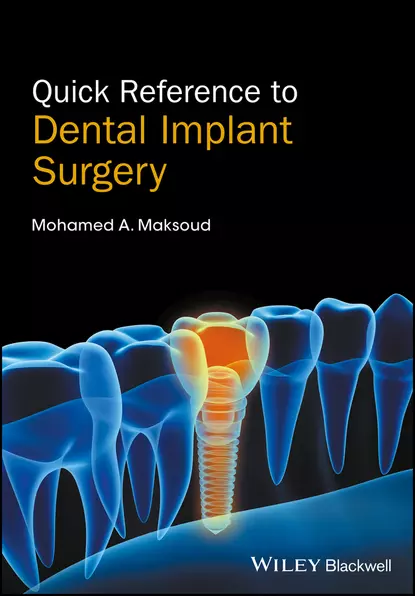 Обложка книги Quick Reference to Dental Implant Surgery, Mohamed A. Maksoud