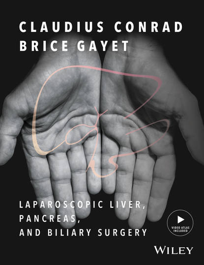 Laparoscopic Liver, Pancreas, and Biliary Surgery - Группа авторов