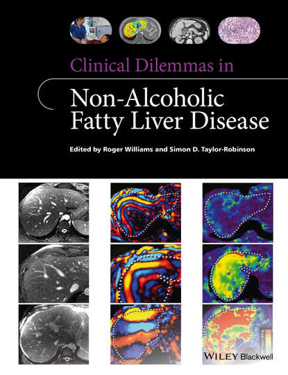 Clinical Dilemmas in Non-Alcoholic Fatty Liver Disease - Roger  Williams