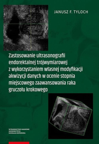 Janusz F. Tyloch - Zastosowanie ultrasonografii endorektalnej trójwymiarowej z wykorzystaniem własnej modyfikacji akwizycji danych w ocenie stopnia miejscowego zaawansowania raka gruczołu krokowego