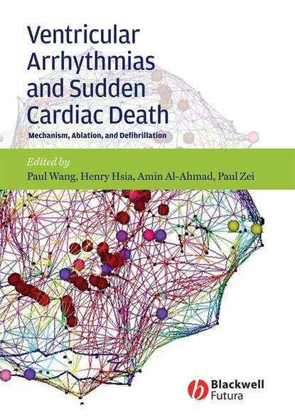 Paul  Wang - Ventricular Arrhythmias and Sudden Cardiac Death