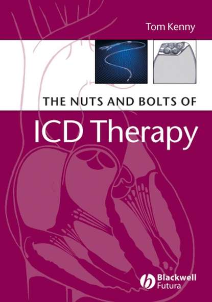 Группа авторов - The Nuts and Bolts of ICD Therapy