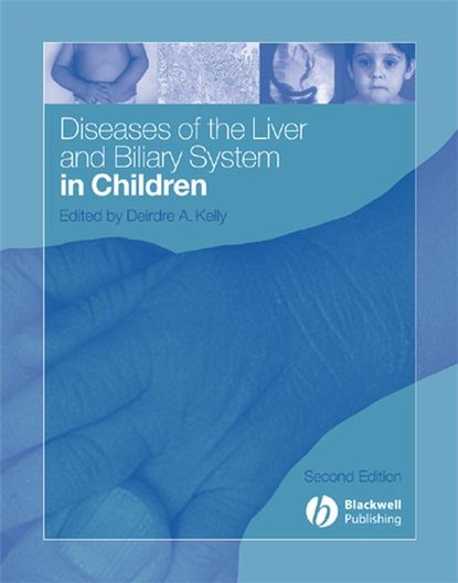 Группа авторов - Diseases of the Liver and Biliary System in Children