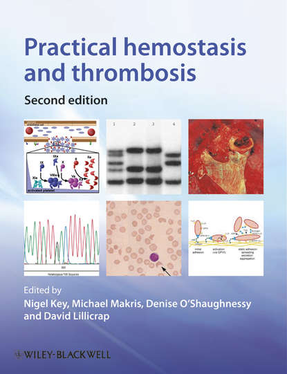 Practical Hemostasis and Thrombosis - Michael  Makris