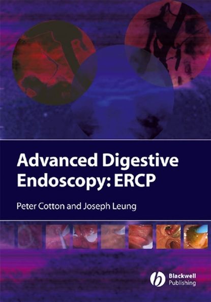 Peter Cotton B. - Advanced Digestive Endoscopy