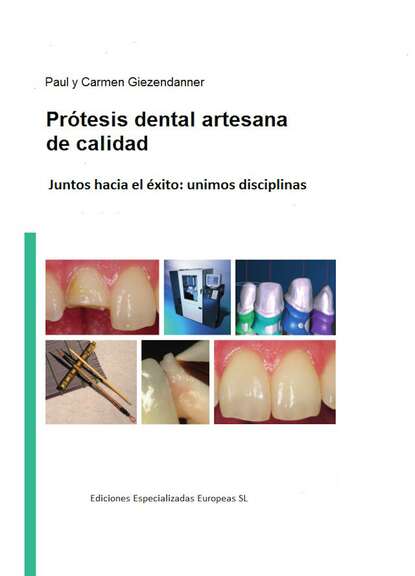 Prótesis dental artesanal de calidad - Paul Giezendanner