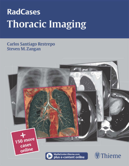 Группа авторов - Thoracic Imaging