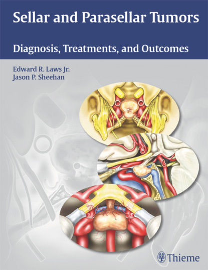 Группа авторов - Sellar and Parasellar Tumors