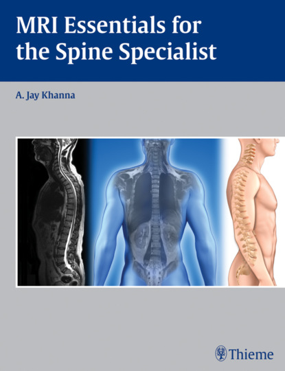 Группа авторов - MRI Essentials for the Spine Specialist