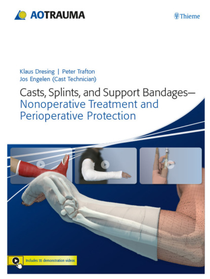 Klaus Dresing - Casts, Splints, and Support Bandages