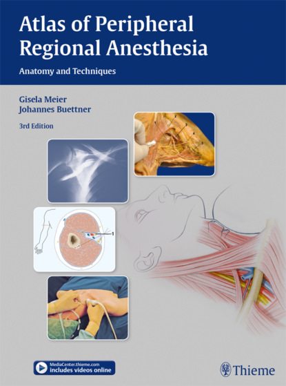 Gisela Meier - Atlas of Peripheral Regional Anesthesia