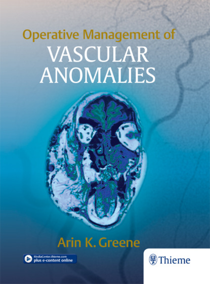 

Operative Management of Vascular Anomalies