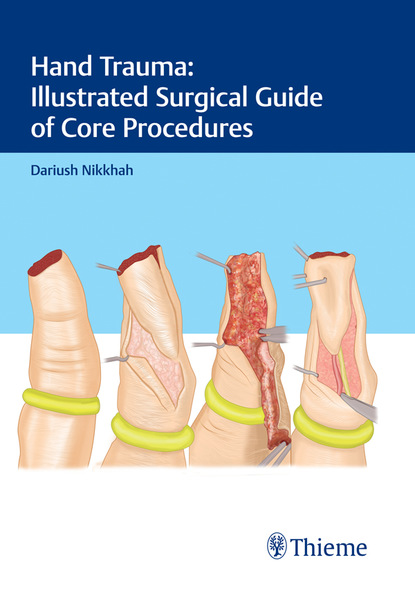 Dariush Nikkhah - Hand Trauma: Illustrated Surgical Guide of Core Procedures