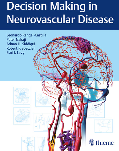 Peter Nakaji - Decision Making in Neurovascular Disease