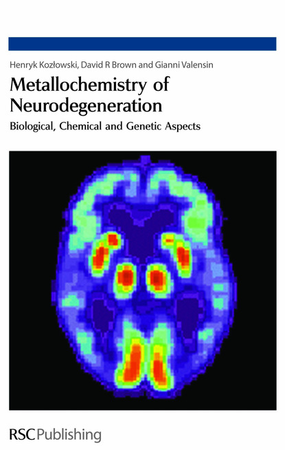 Henryk Kozlowski - Metallochemistry of Neurodegeneration