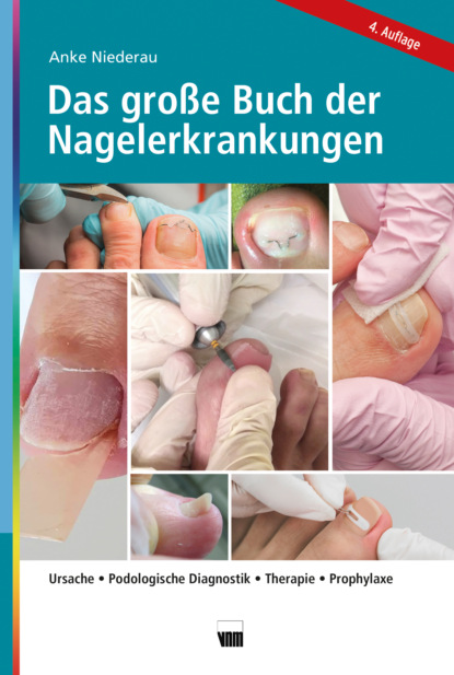 Anke Niederau - Das große Buch der Nagelerkrankungen