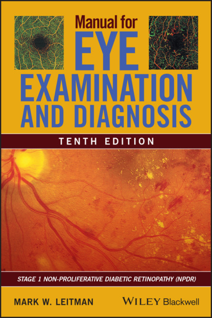 Mark W. Leitman - Manual for Eye Examination and Diagnosis