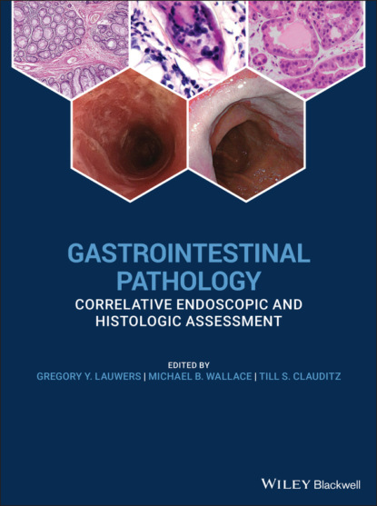Группа авторов - Gastrointestinal Pathology