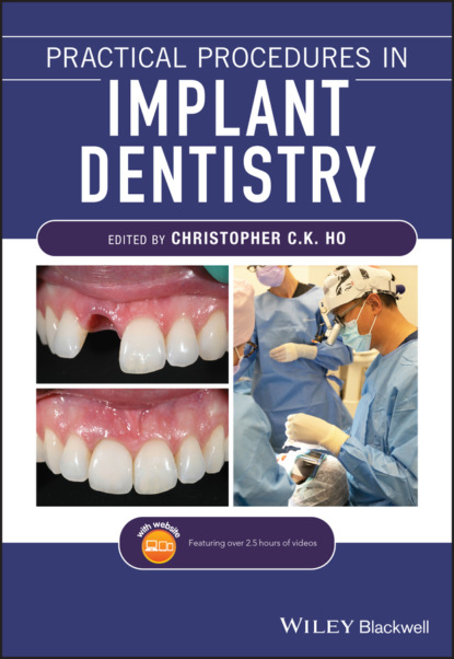 Группа авторов - Practical Procedures in Implant Dentistry