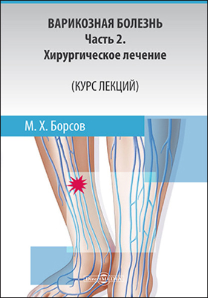 Варикозная болезнь: Часть 2 (Мухамед Хамзатович Борсов). 