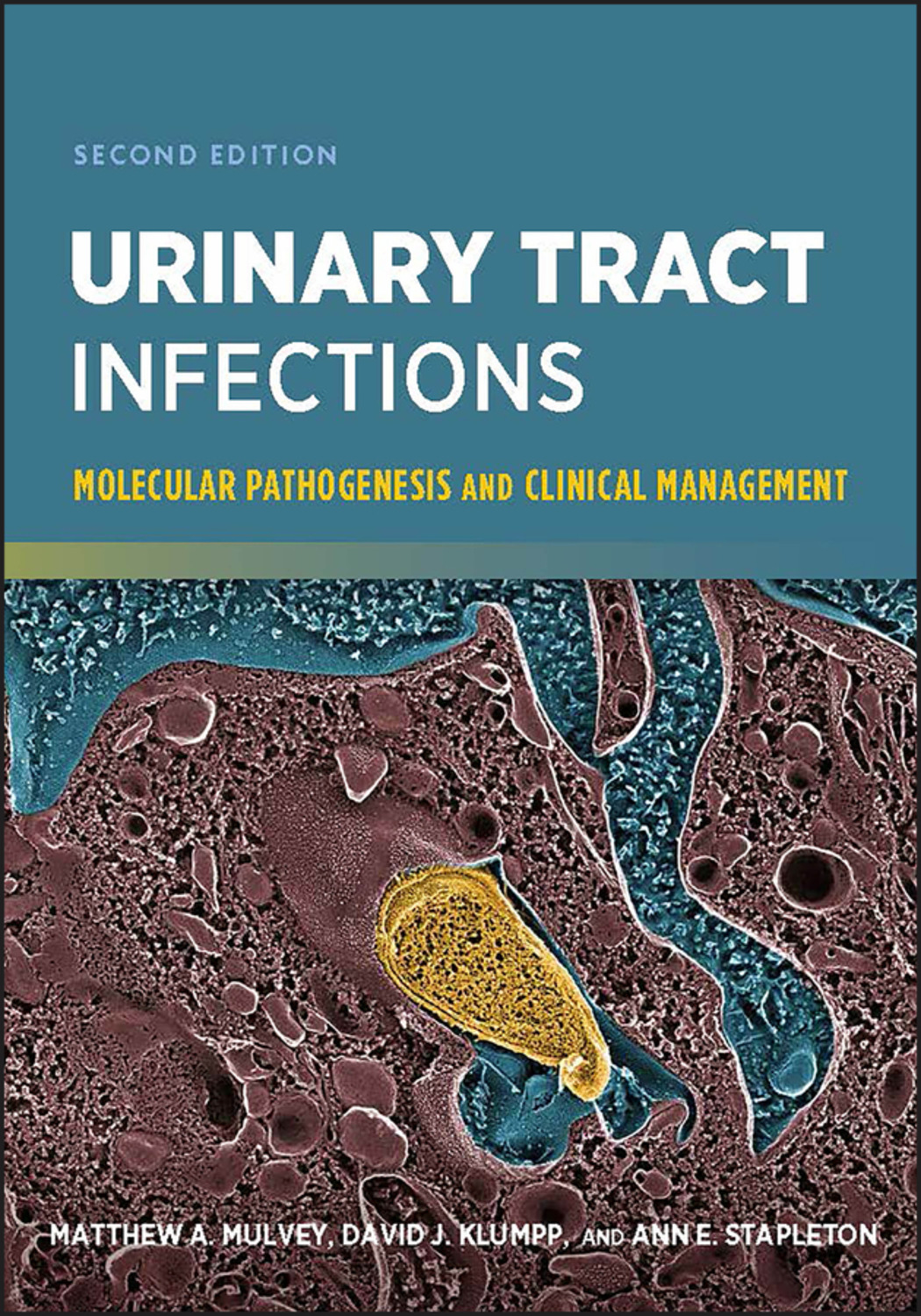 Matthew A. Mulvey, Urinary Tract Infections   Molecular Pathogenesis 